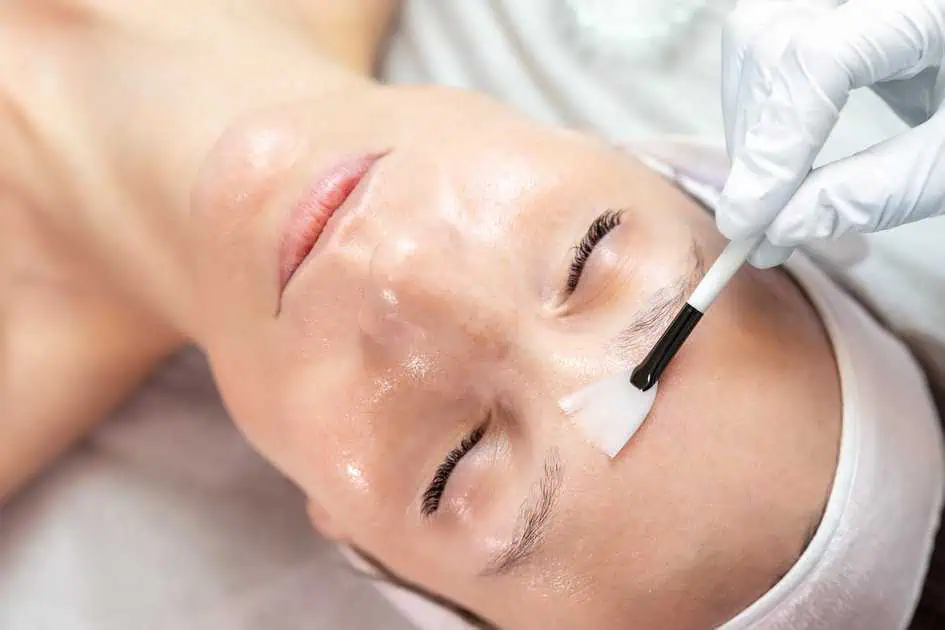 Chemical Peels in Las Vegas, NV by RejuvLV Wellness & Aesthetics