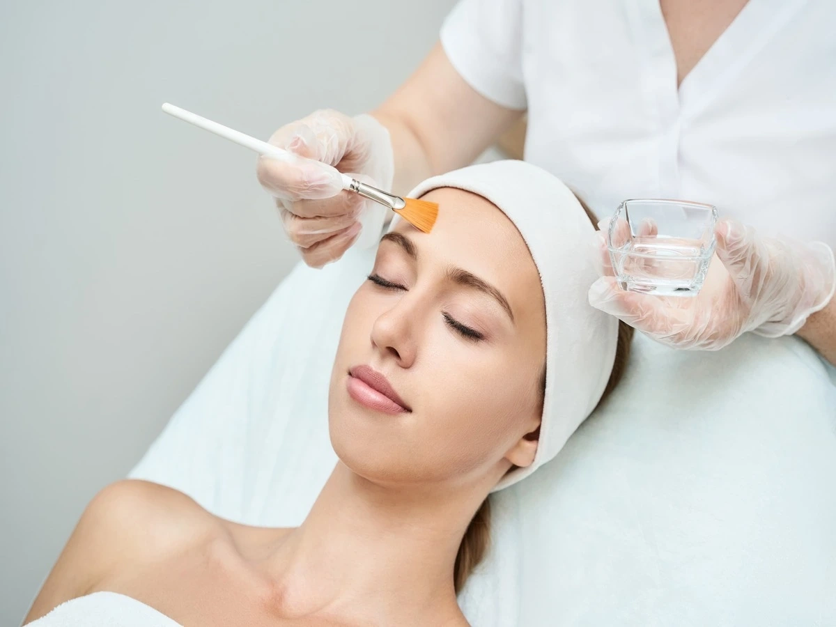 Chemical Peels Treatment
