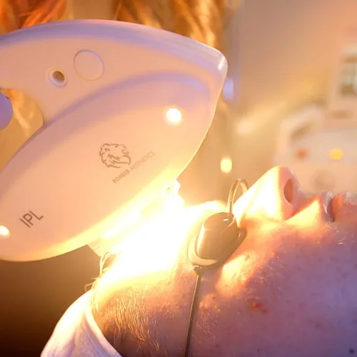 IPL photofacial laser treatment | RejuvLV Wellness & Aesthetics | Las Vegas, NV