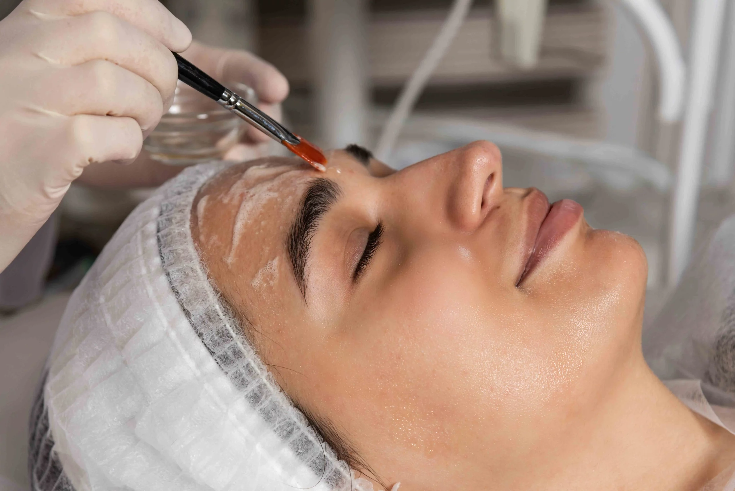 chemical peel treatments in rejuvlv wellness las Vegas, nv